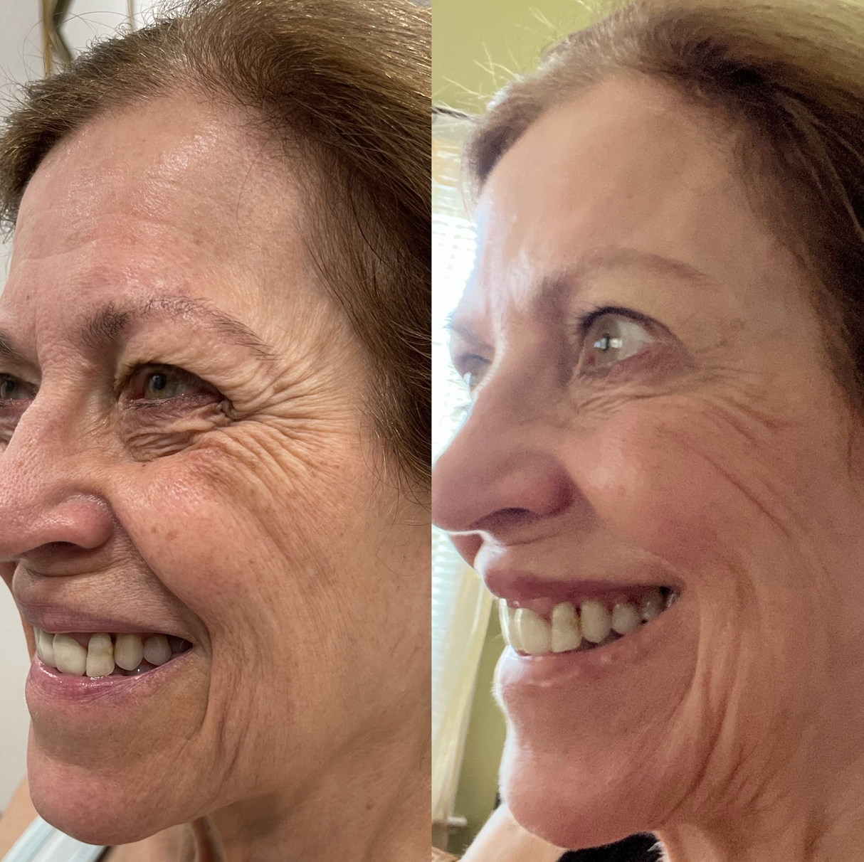 Screen Shot 2023-09-22 at 2.37.40 PM.png