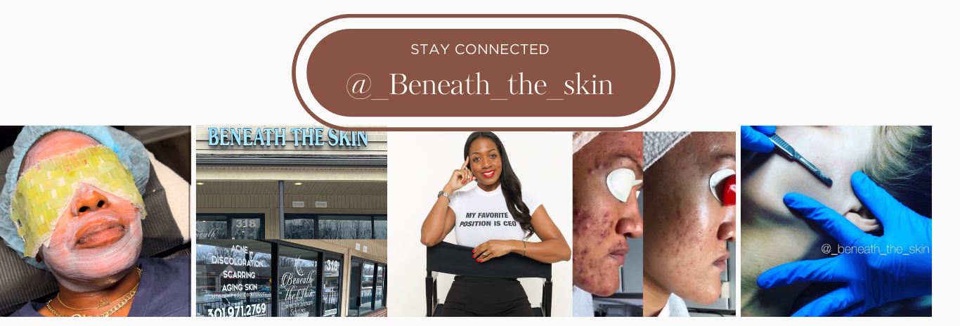 Benth Skin Beneath the Skin