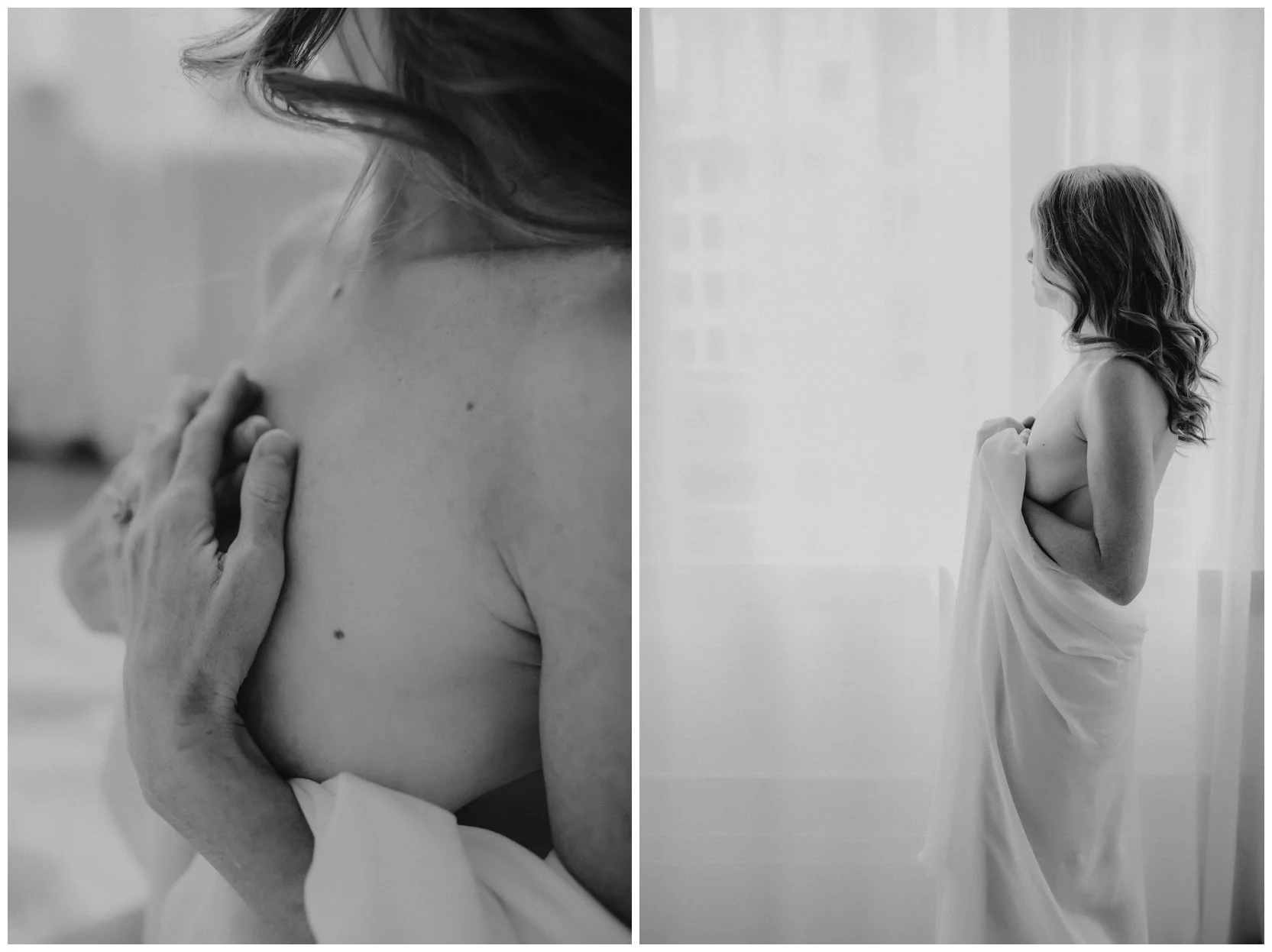 Intimate pre-surgery body documentation photography Cleveland Ohio