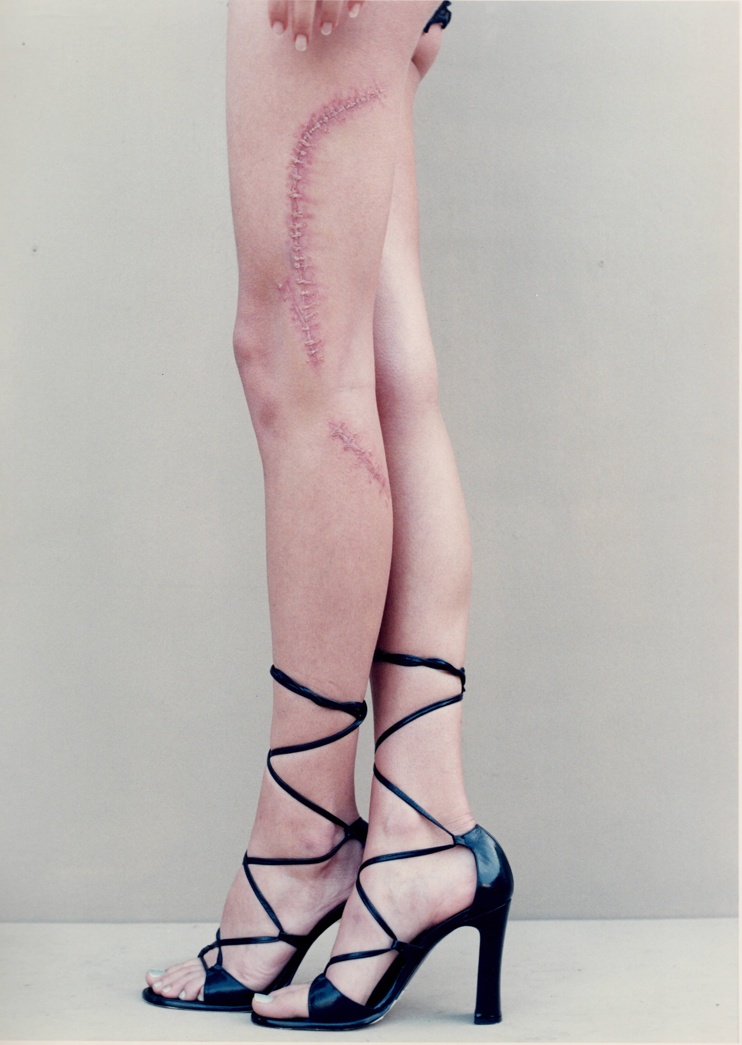 Shark Bite Scars - Monet Mazur