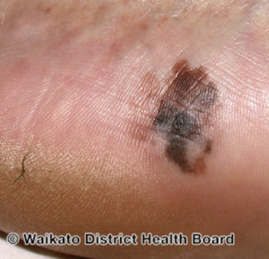 Macroscopic/Microscopic Terminology