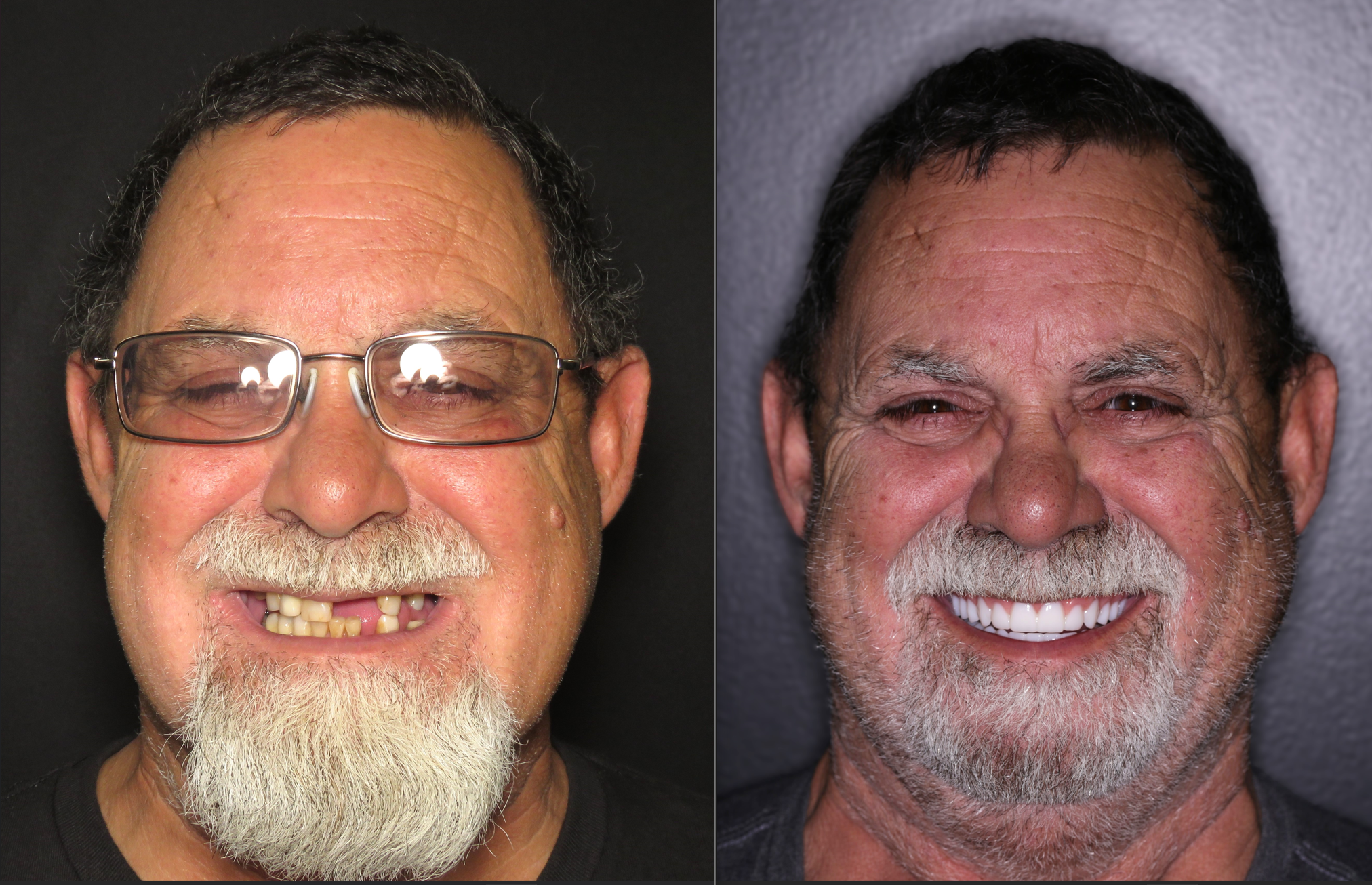 Roger B&A.png