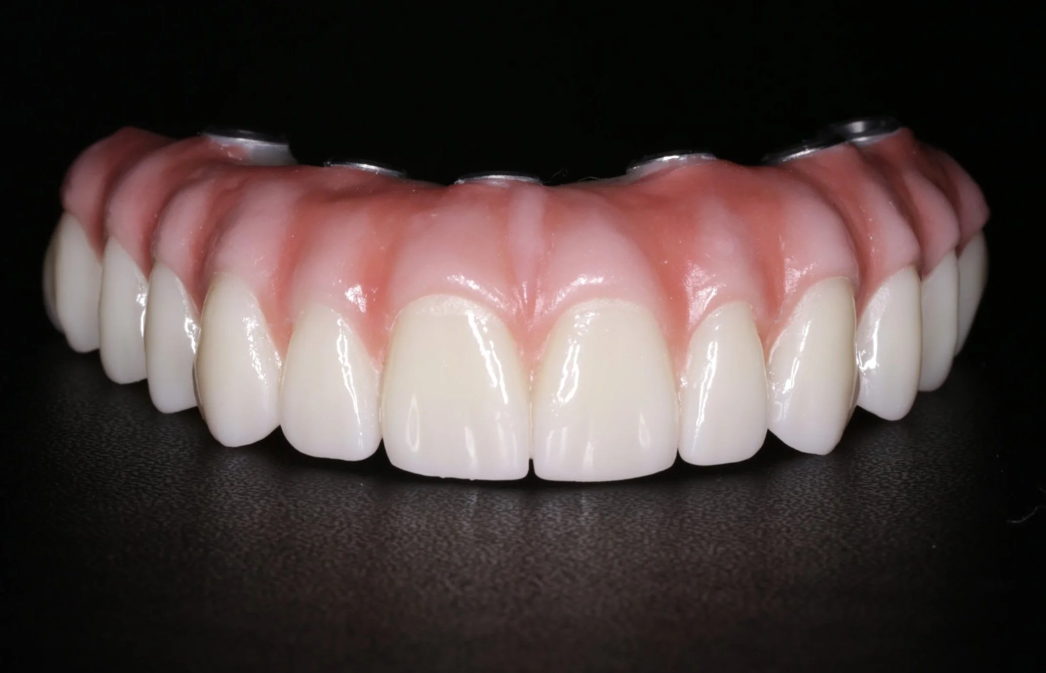Affordable implants in Puyallup Washington