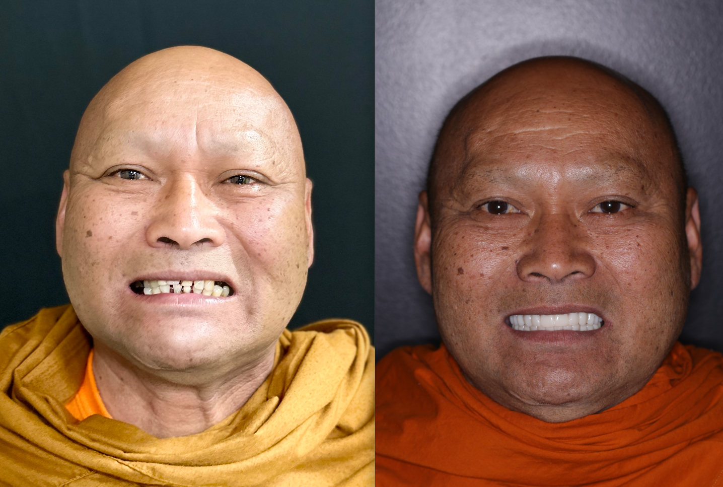 Monk B&A.png