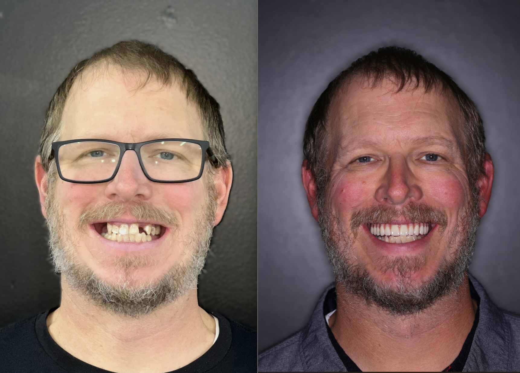 B&A.png