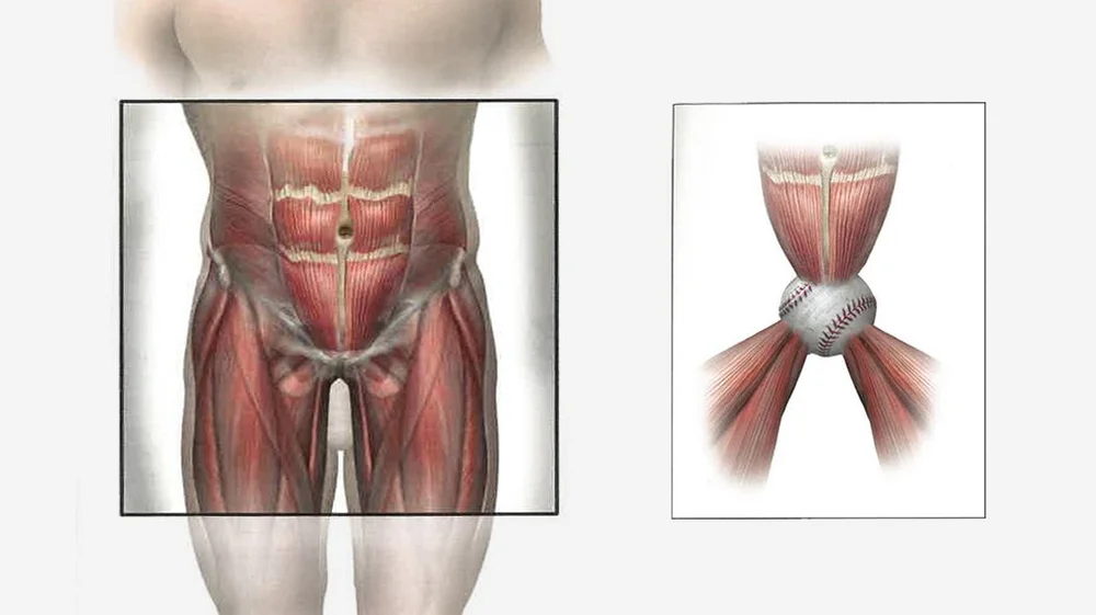 Core Injury, Athletic Pubalgia and Sports Hernia: Treatments for Core ...