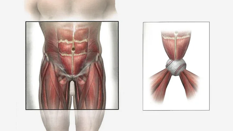 Core Injury, Athletic Pubalgia and Sports Hernia: Treatments for Core ...