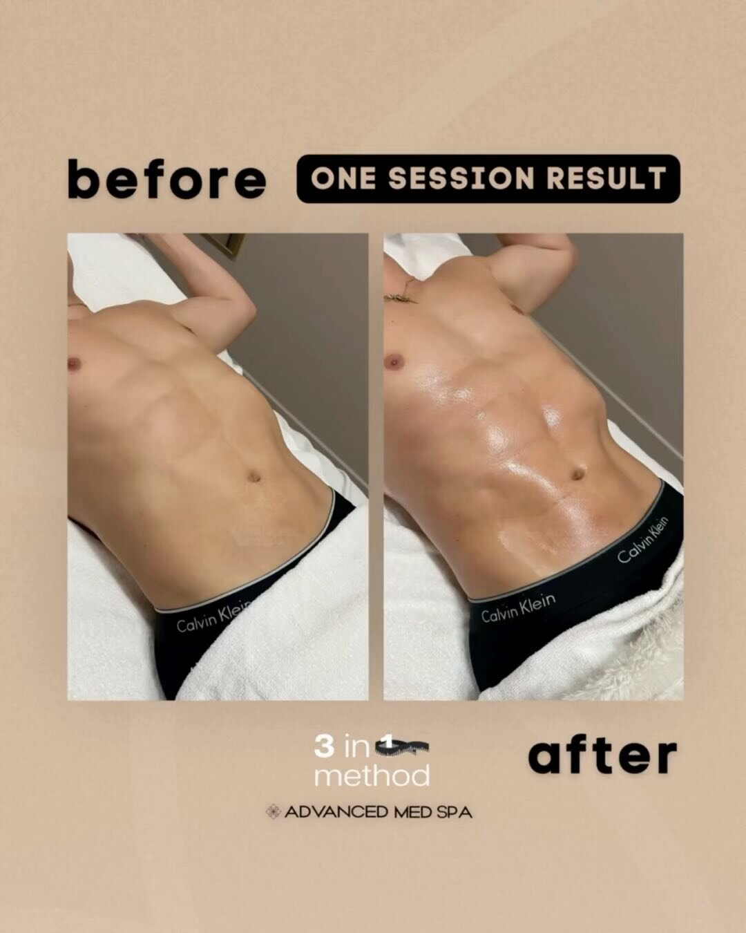 ONE HOUR DIFFERENCE 😍⁠
This is our signature Brazilian lymphatic drainage procedure, the 3 in 1 Method 👐🏼⁠
⁠
While this treatment is amazing year-round, our patients love it even more during the busy holiday season 🎅🏼🎄 WHY? ⁠
⁠
Because it&rsquo