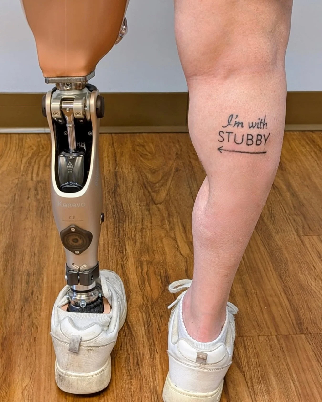 Attitude is everything.

For our patient, that means wearing her story proudly with a smile and a great sense of humor.

She&rsquo;s living proof that your only disability in this life is a bad attitude, and we love celebrating the positivity and per