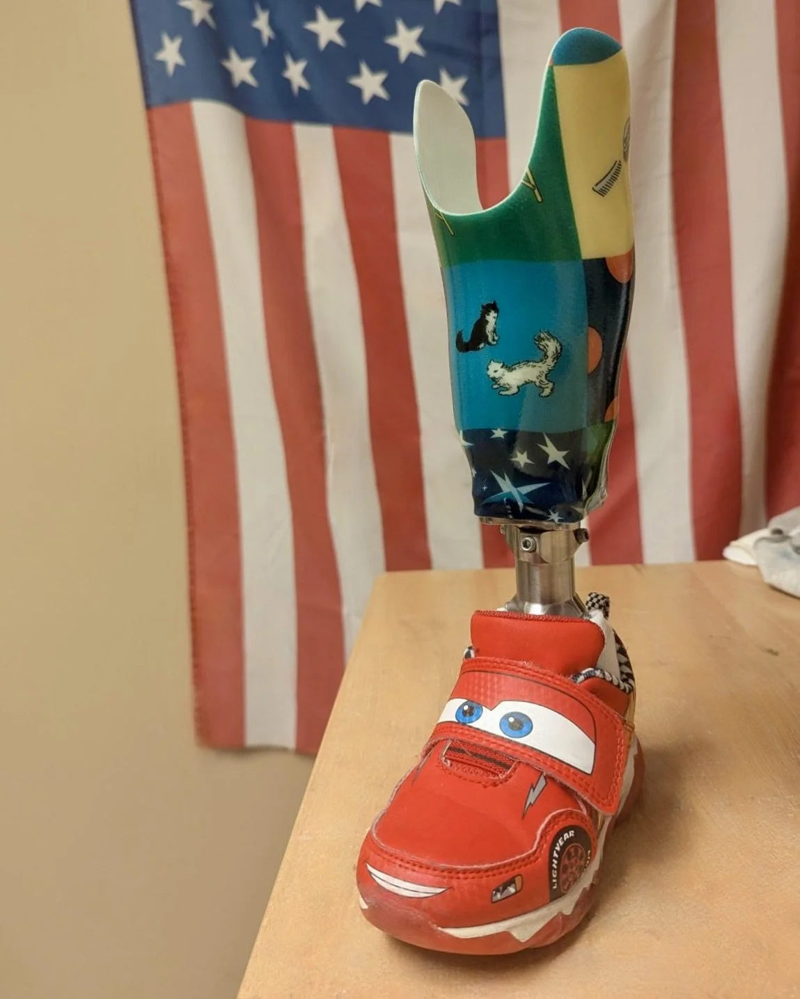 How Custom Pediatric Prosthetic Sockets Help Kids Thrive: Dayton Children’s Patient Receives Goodnight Moon Design
