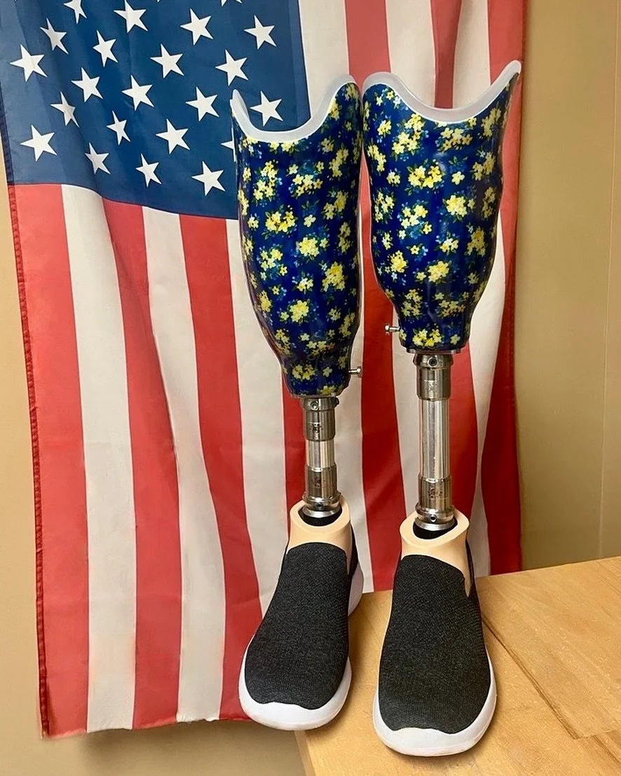 Out with the old, in with the &lsquo;blue&rsquo;.

A new year means new beginnings and many new journeys ahead, so it&rsquo;s a great time to check in on your mobility. 

If you've noticed changes in the comfort or fit of your prosthesis, schedule ti