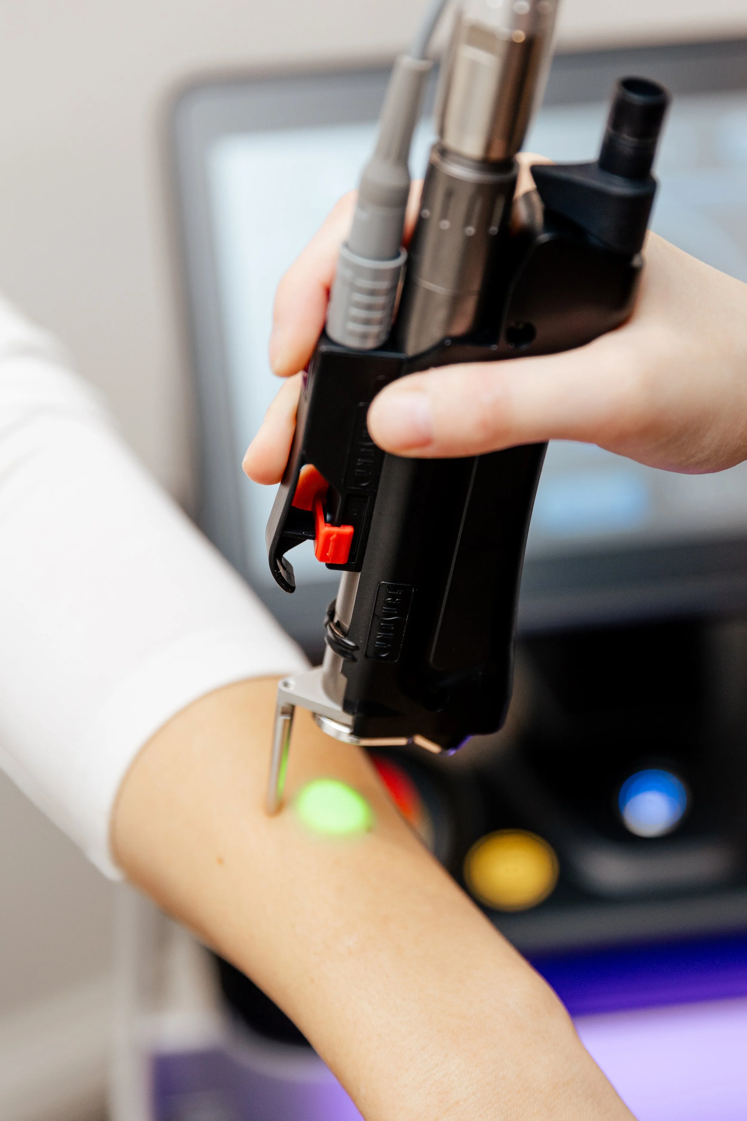 Laser Hair Removal in Waterloo Region: What the Elite iQ Changes