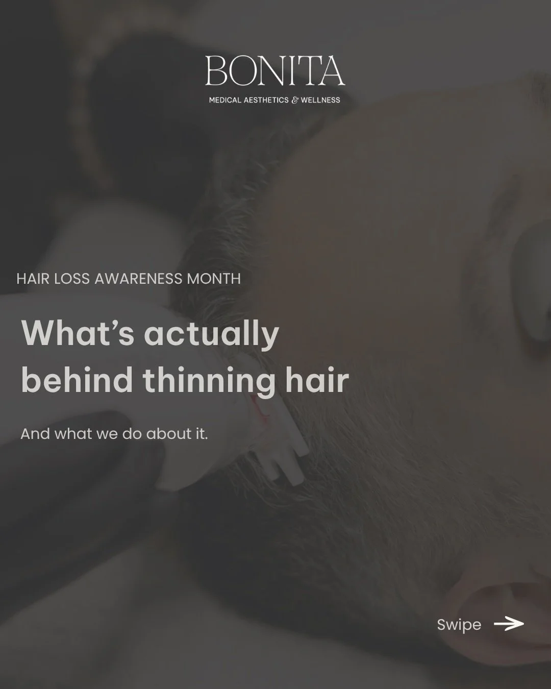 If your hair has felt a little different lately, you&rsquo;re not alone and it&rsquo;s more common than you&rsquo;d think.

Ultra Hair Restoration pairs LaseMD Ultra with Kerafactor to work with the cycle your hair already has, not against it.

This 