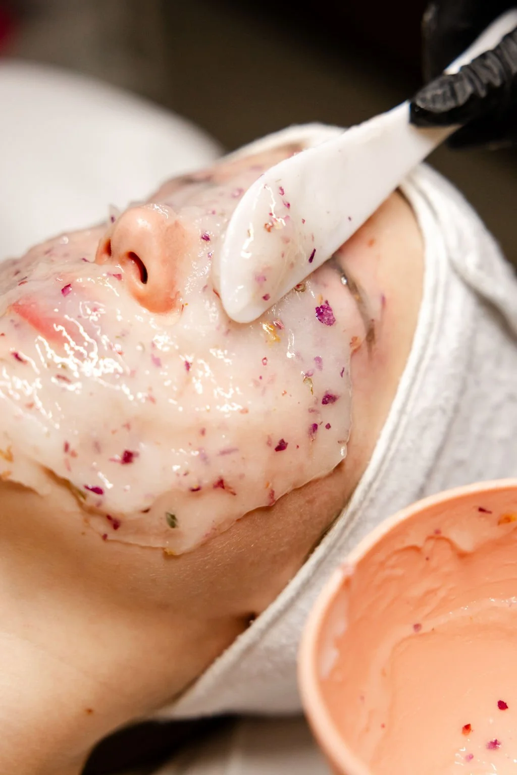 Acne Isn’t Just a Teen Thing — It’s More Than Just Skin Deep