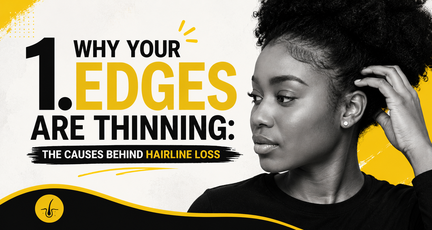 Why Your Edges Are Thinning: The Causes Behind Hairline Loss