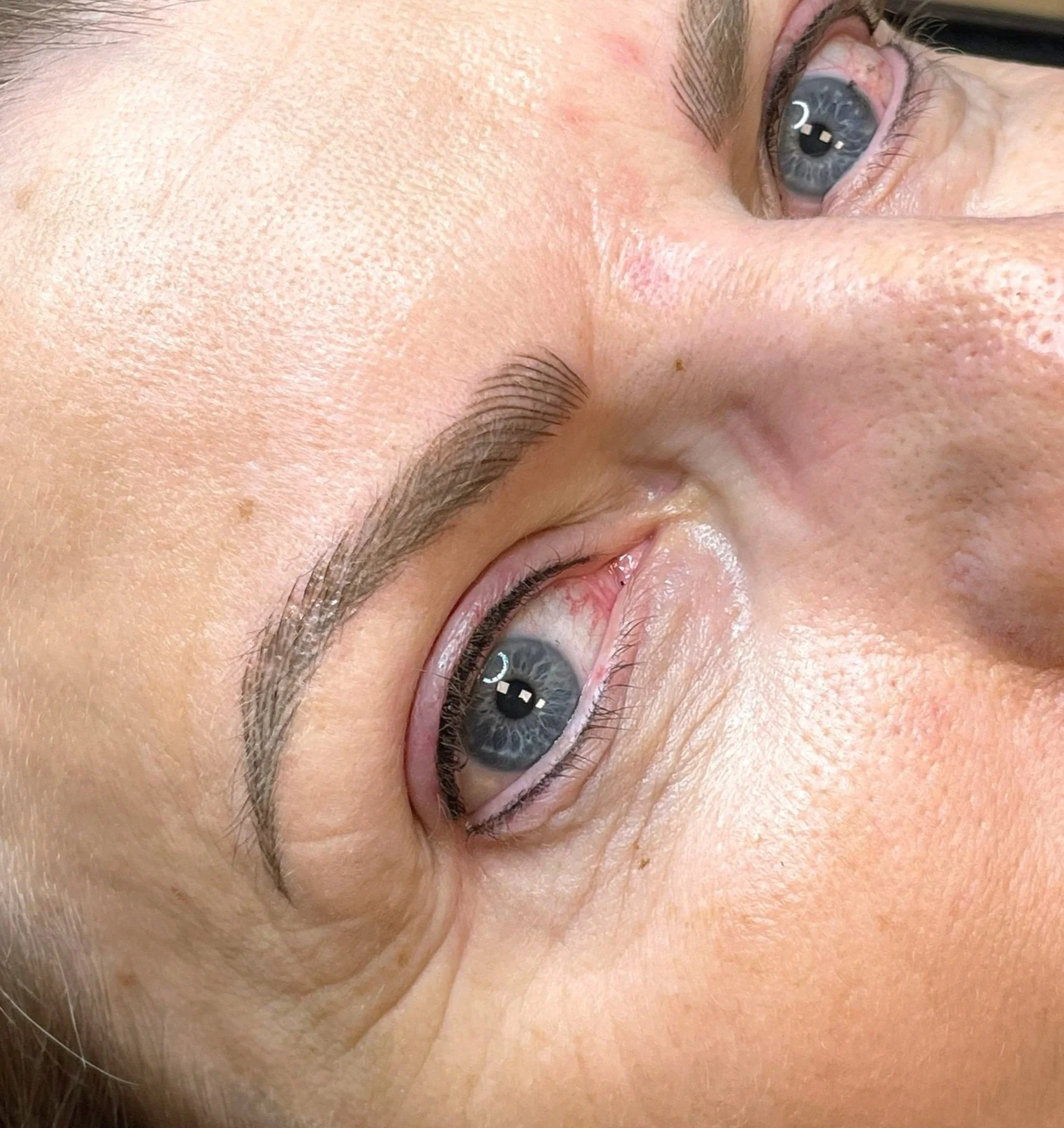 Close-up of a person's eye and surrounding facial skin, with visible blue iris, eyelashes, and eyebrows.