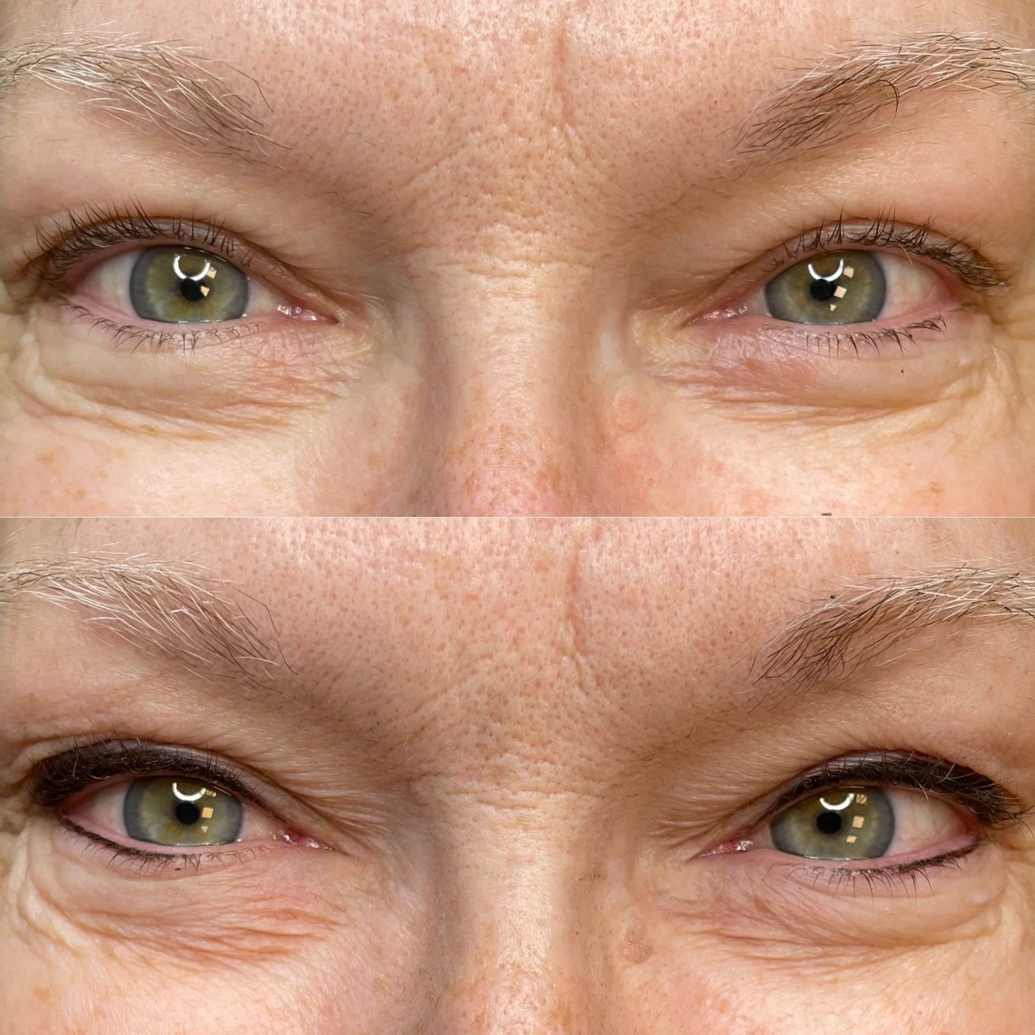 Close-up of a person's face, focusing on the eyes, forehead, and eyebrows, with visible skin texture and light-colored eyebrows.