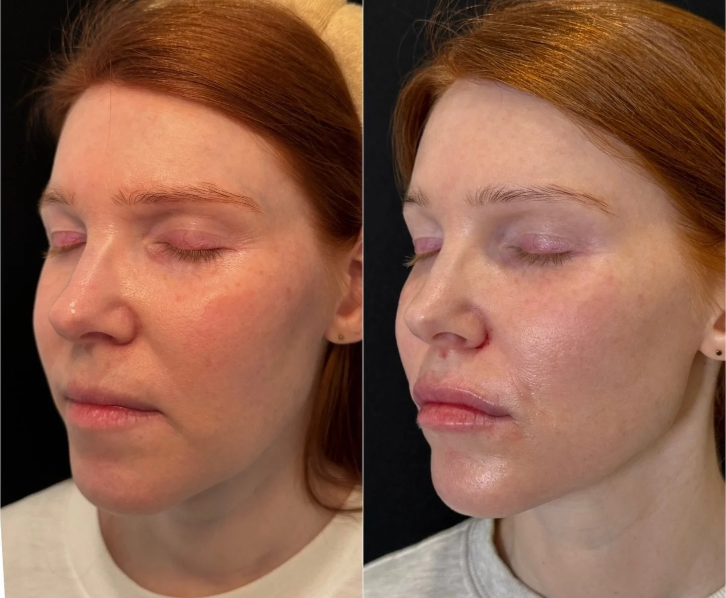 This is what targeted treatments look like:
✔️ IPL for redness &amp; pigmentation
✔️ Tox for smooth lines
✔️ Filler for natural balance

✨ Results designed for longevity, not just the moment.