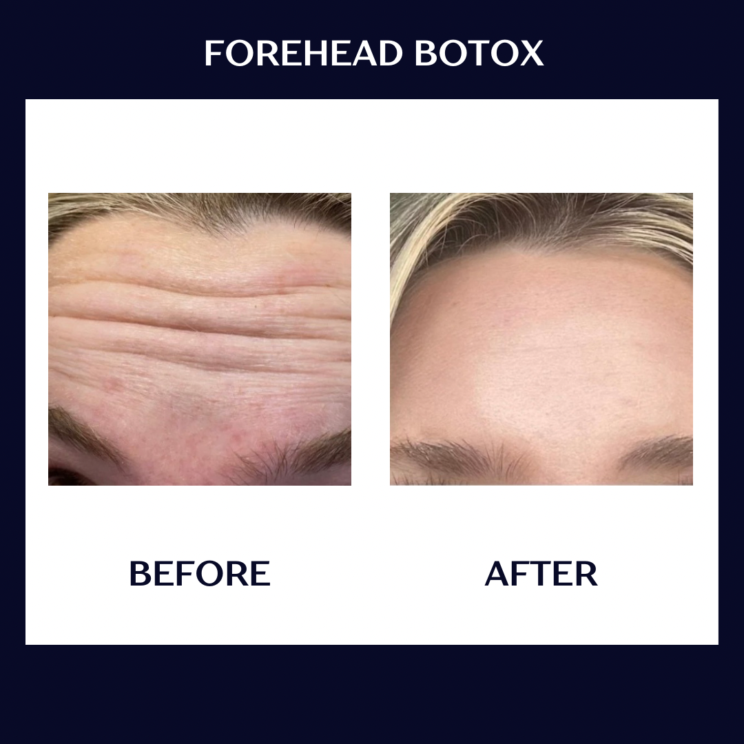 tox b+a.PNG
