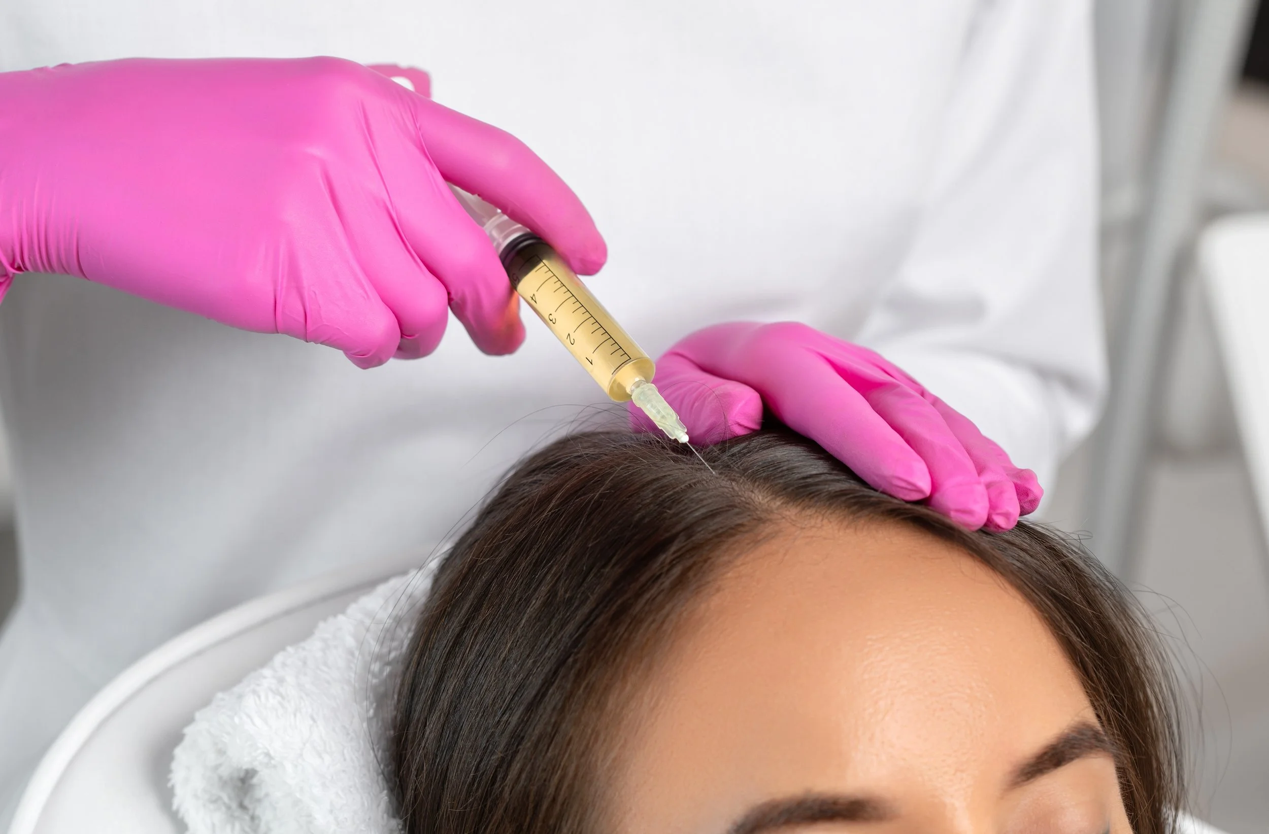 Woman receiving PRF Treatment at San Clemente, CA medical spa.
