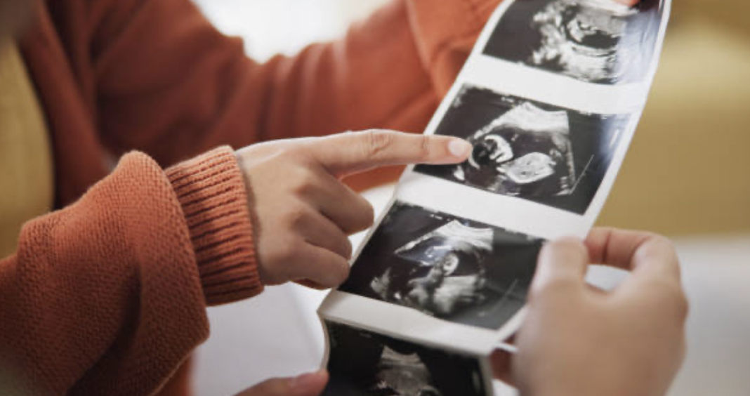 Who Starts Labor? Research Says: Baby Might Be in Charge