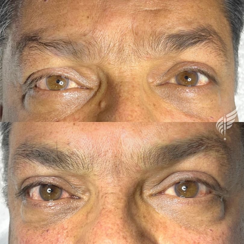 Brow Tattoo Microblading for Men Los Angeles Hollywood