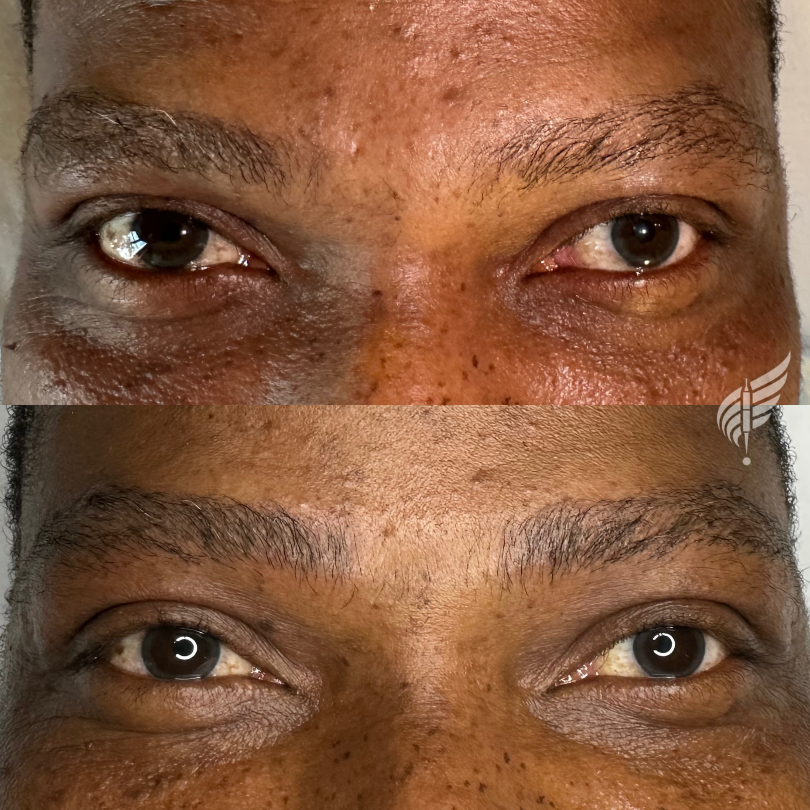 Brow Tattoo Microblading for Men Los Angeles Hollywood