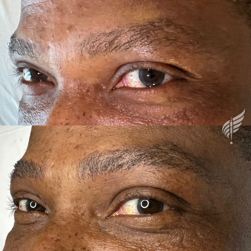 Brow Tattoo Microblading for Men Los Angeles Hollywood
