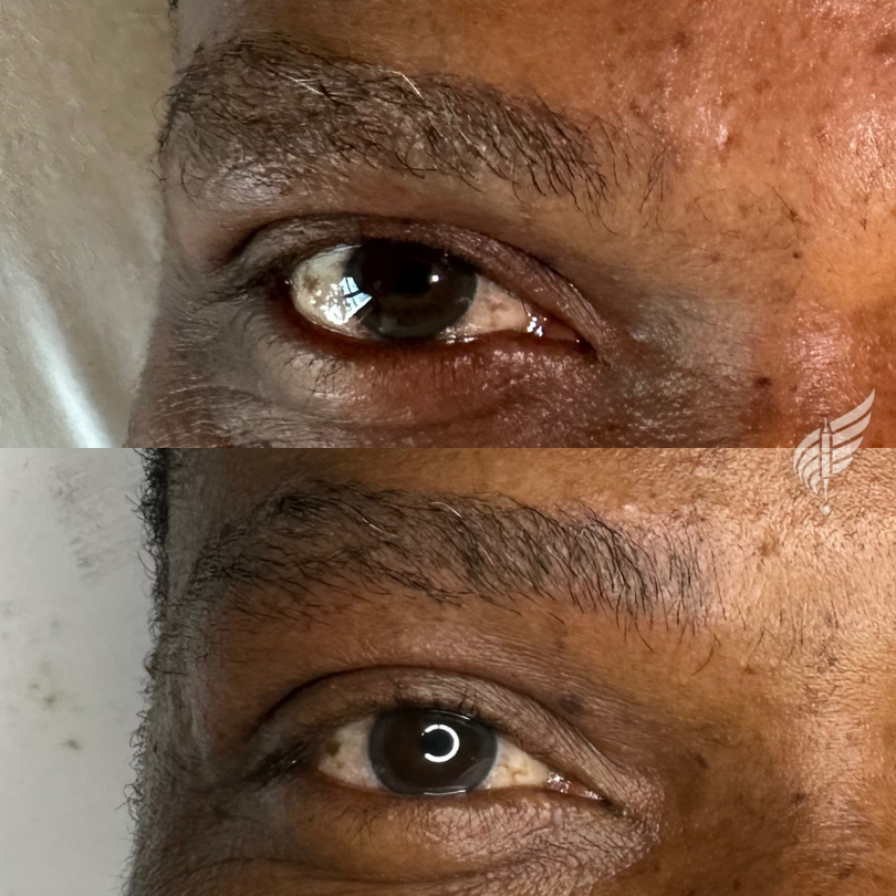 Brow Tattoo Microblading for Men Los Angeles Hollywood