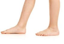 Pieds plats ? Quand devez-vous vous Agir?Par Catherine Langevin-Cusson D.O.