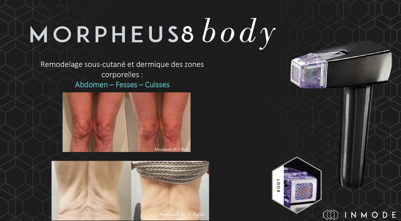 Tips Body 1.jpeg
