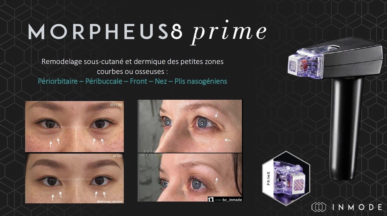 Tips Prime 1.jpeg