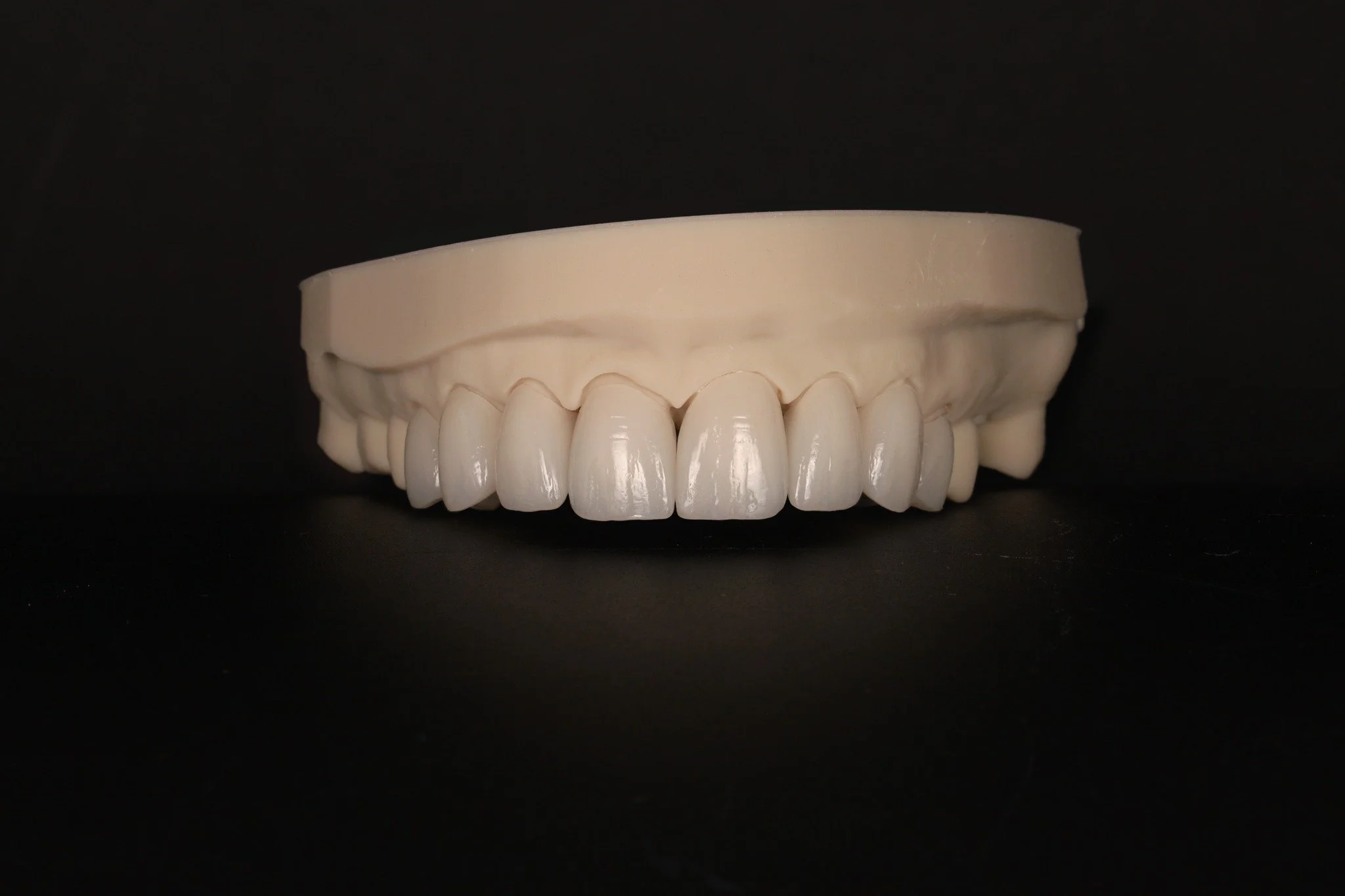 ✨8 unit anterior e.max veneers &amp; crowns ✨

#ZirconiaCrowns #DentalCeramics #RestorativeArt #CrownAndBridge #DentalRestorations #Veneers 
#LabCraftedSmiles #CADCAMDentistry #DentalTechnicianLife
#SmileReconstruction #AestheticZirconia #DentalZirco