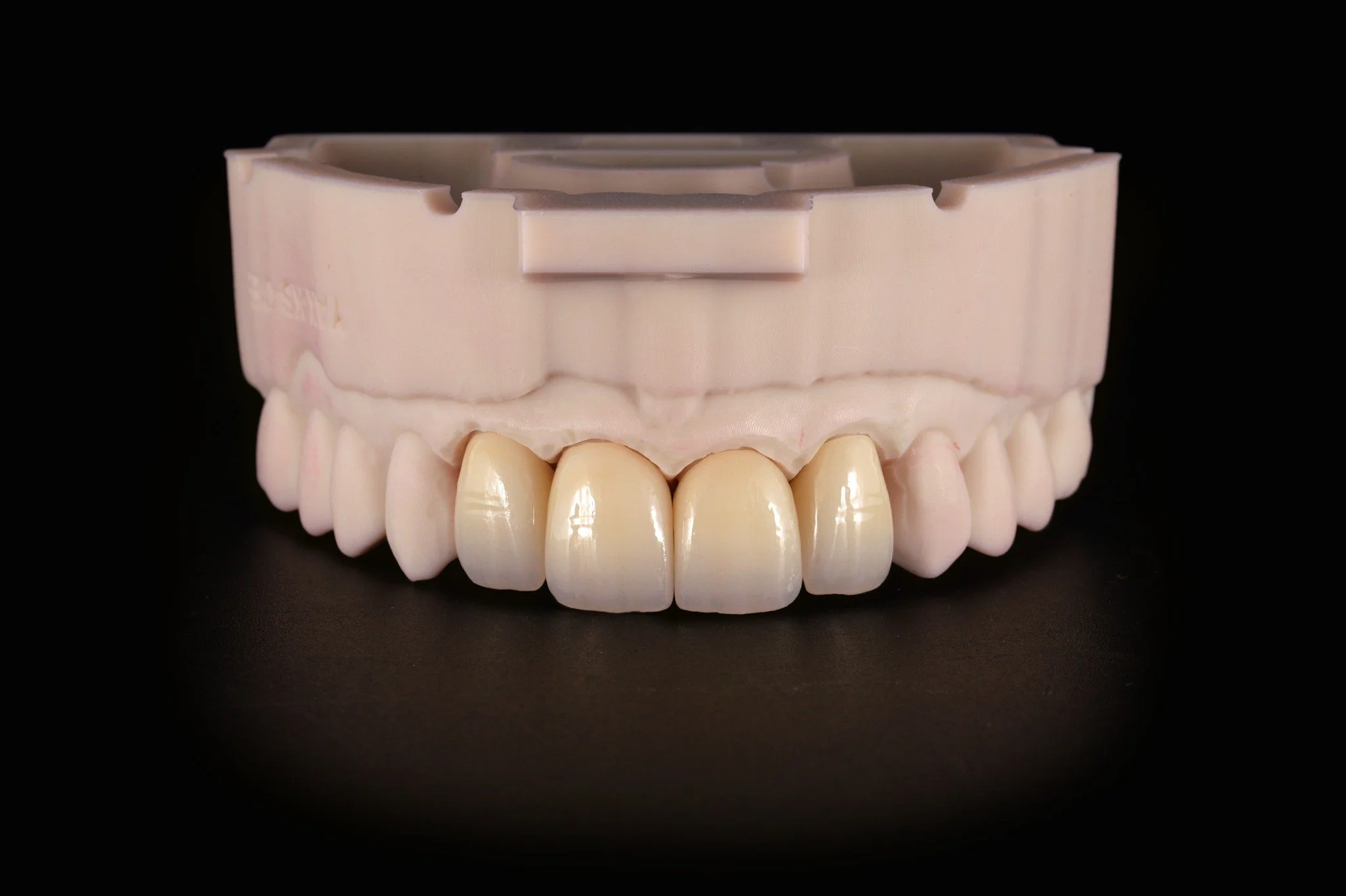 Anterior full contour PureZi restoration. ✨

#DentalArtistry #CustomCeramics #SmileDesign #LabLife #DentalPhotography #ZirconiaRestoration #DentalLabTech #CraftingSmiles #DentistryWorld #QualityDentistry #DigitalDentistry