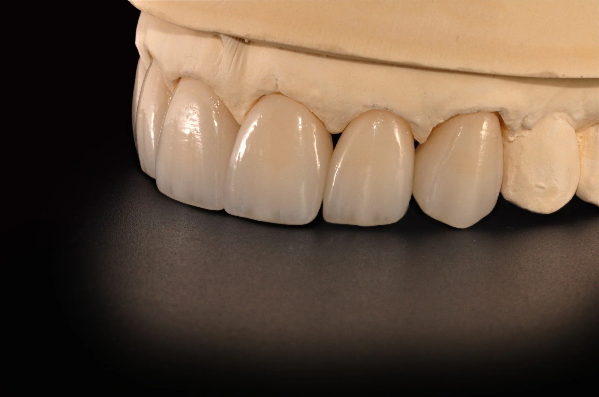 No need to rush. Every contour and shade gets the time it deserves...because we know that details matter.

#DentalArtistry #CustomCeramics #SmileDesign  #LabLife #DentalPhotography #ZirconiaRestoration #DentalLabTech #CraftingSmiles #DentistryWorld #