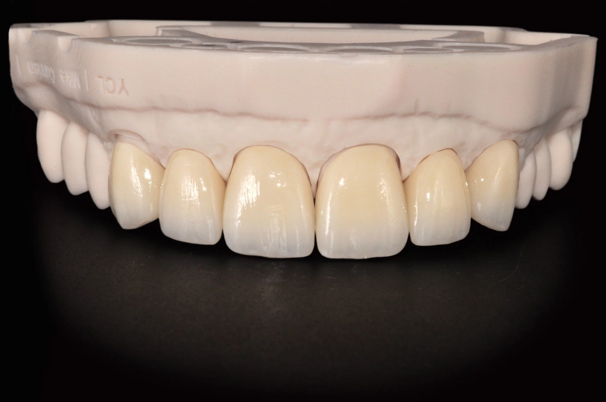Hello world. We've been pretty quiet lately and it's time to change that. Check out this 6 unit zirconia crown set we recently completed. 

#CraftingSmiles #DentistryWorld #QualityDentistry #DigitalDentistry #DentalArtistry #ImplantDentistry #Cosmeti