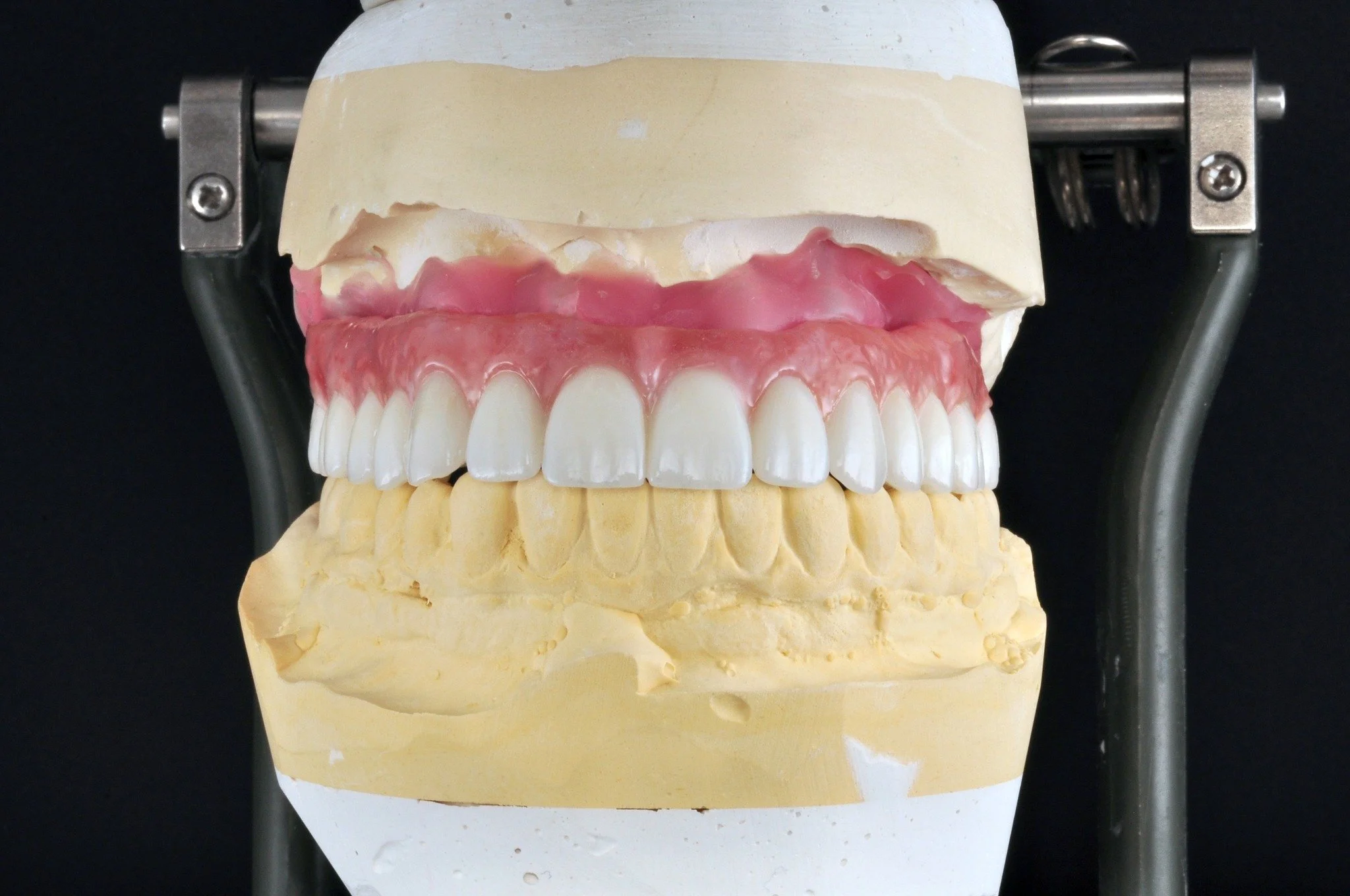 Another beautiful fixed zirconia hybrid restoration, started and completed for @dentalstudioofpasadena by the talented technicians of GIE Dental Lab.

Visit our website at www.giedentallab.com to see more of our work!

#DentalExcellence #DentalArtist