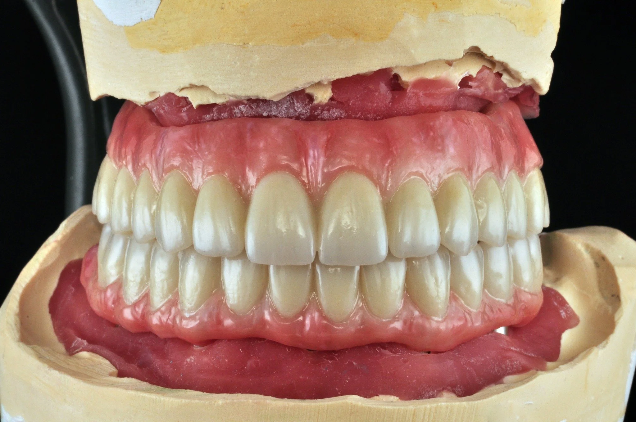 ✨ Our latest multi-unit Z-Ceram implant restoration. Designed and milled in-house using our @rolanddga DWX-52DCi.  Glazed, stained, and finished by GIE's master class technicians. 

Case started and delivered by @hamletdavari_dds 

💻✨Visit our websi
