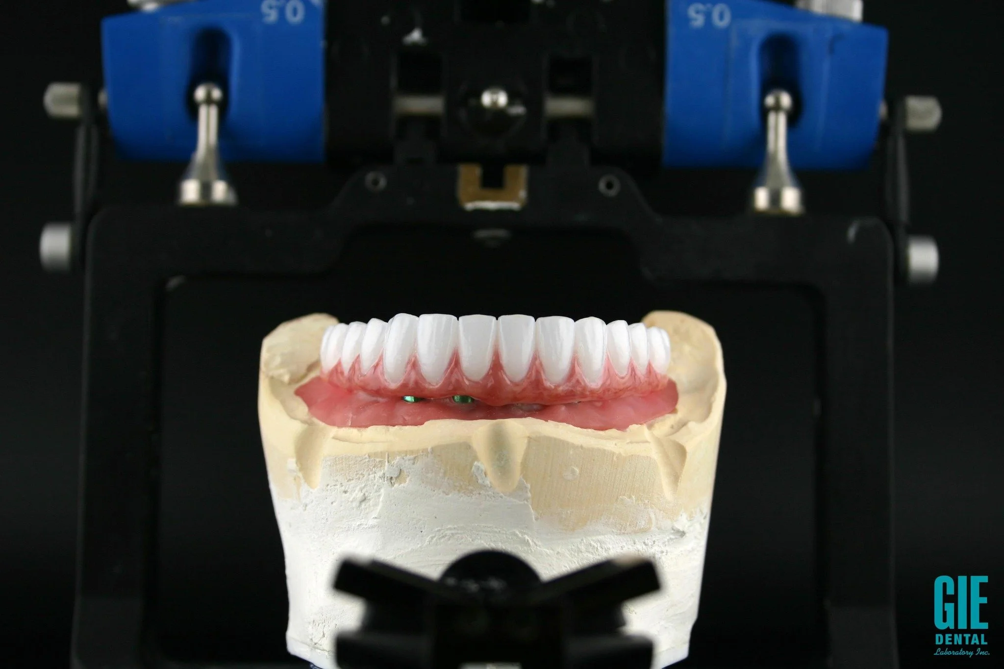 A beautiful lower arch hybrid fixed screw-retained zirconia bridge; designed, milled, and completed by our master technicians. ✨

Case started and completed by @drvahikmeserkhani of @la.dentists.group 

💻✨Visit our website at www.giedentallab.com to
