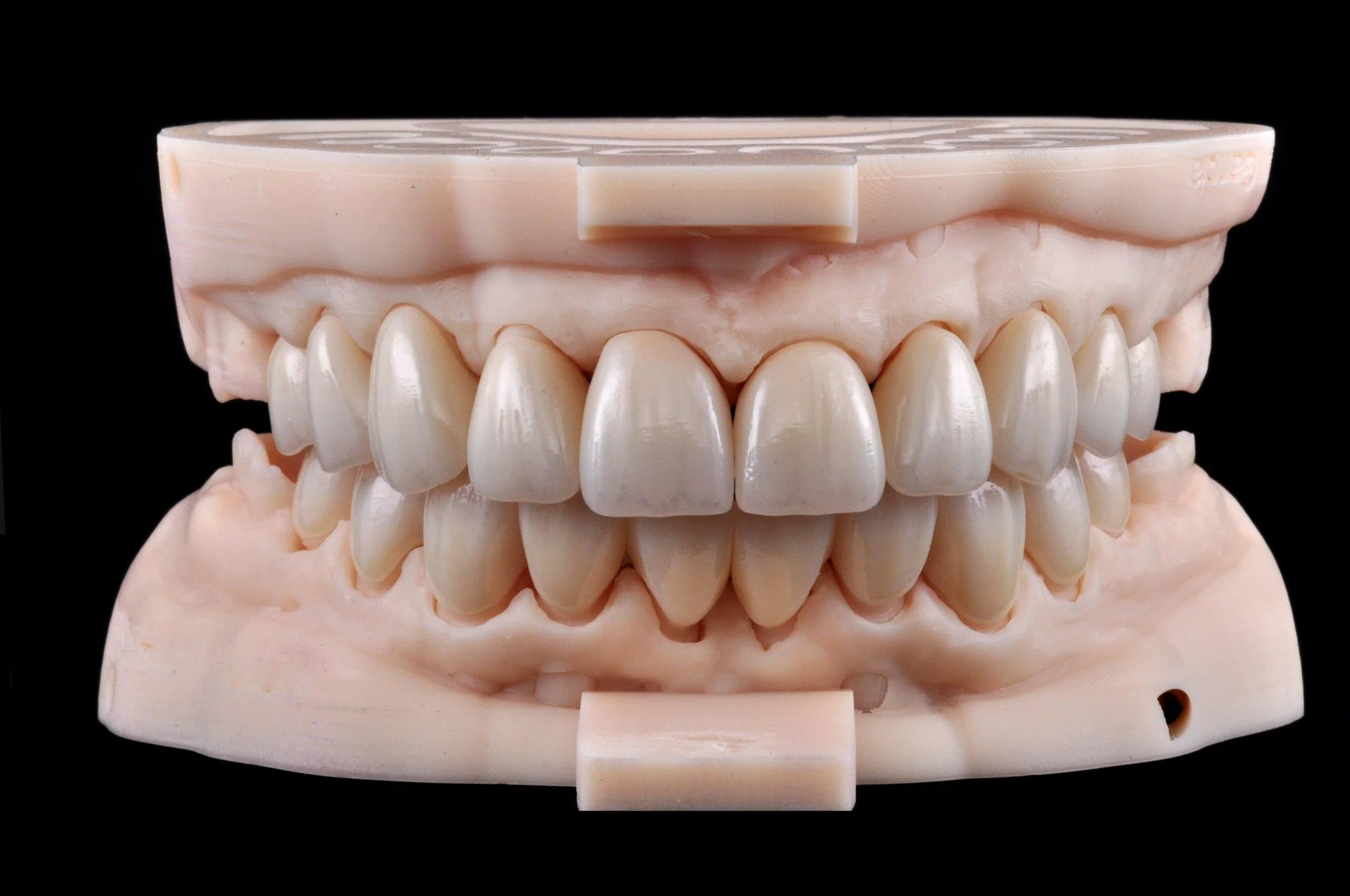Precision in every detail, excellence in every smile. Presenting our latest masterpiece: a flawless set of 20-unit full zirconia crowns. VDO adjusted digitally using @3shape CAD 🌟

Case started and completed by @drjeffpapworth at @starwhitedental

C