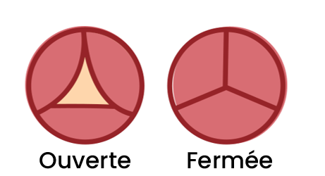 Sténose aortique — Heart Valve Voice Canada