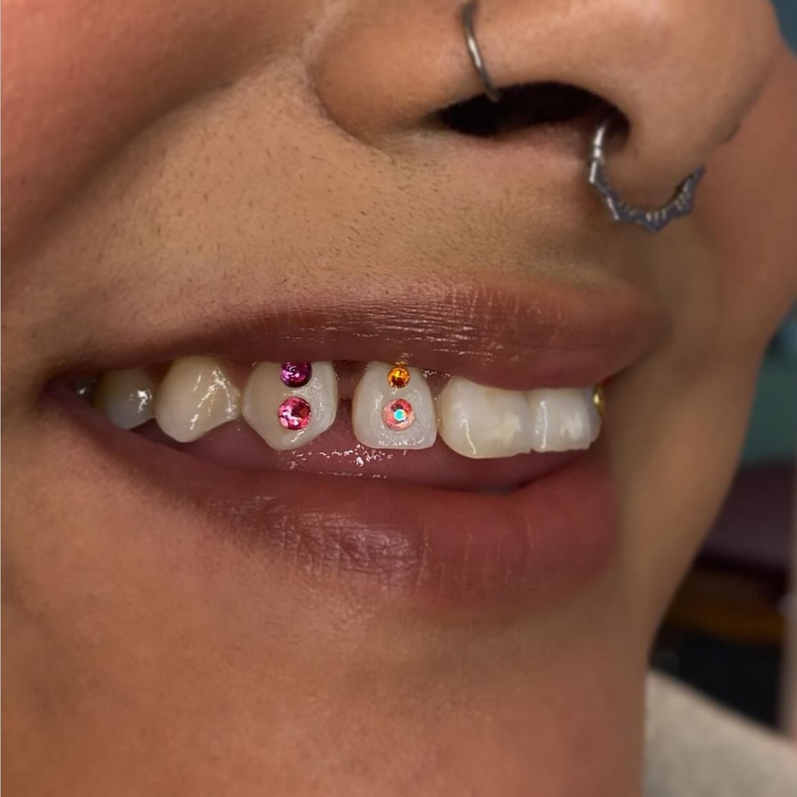 Tooth gems by @mega_gems ✨✨✨ DM her to book @mega_gems @mega_gems @mega_gems #chicago #chicagotattooartist #chicagotattoos #chicagotattooshops #thingstodoinchicago #chicagoland #chicagogram #chicagotoothgems #logansquare #wickerpark #bucktown #ravens