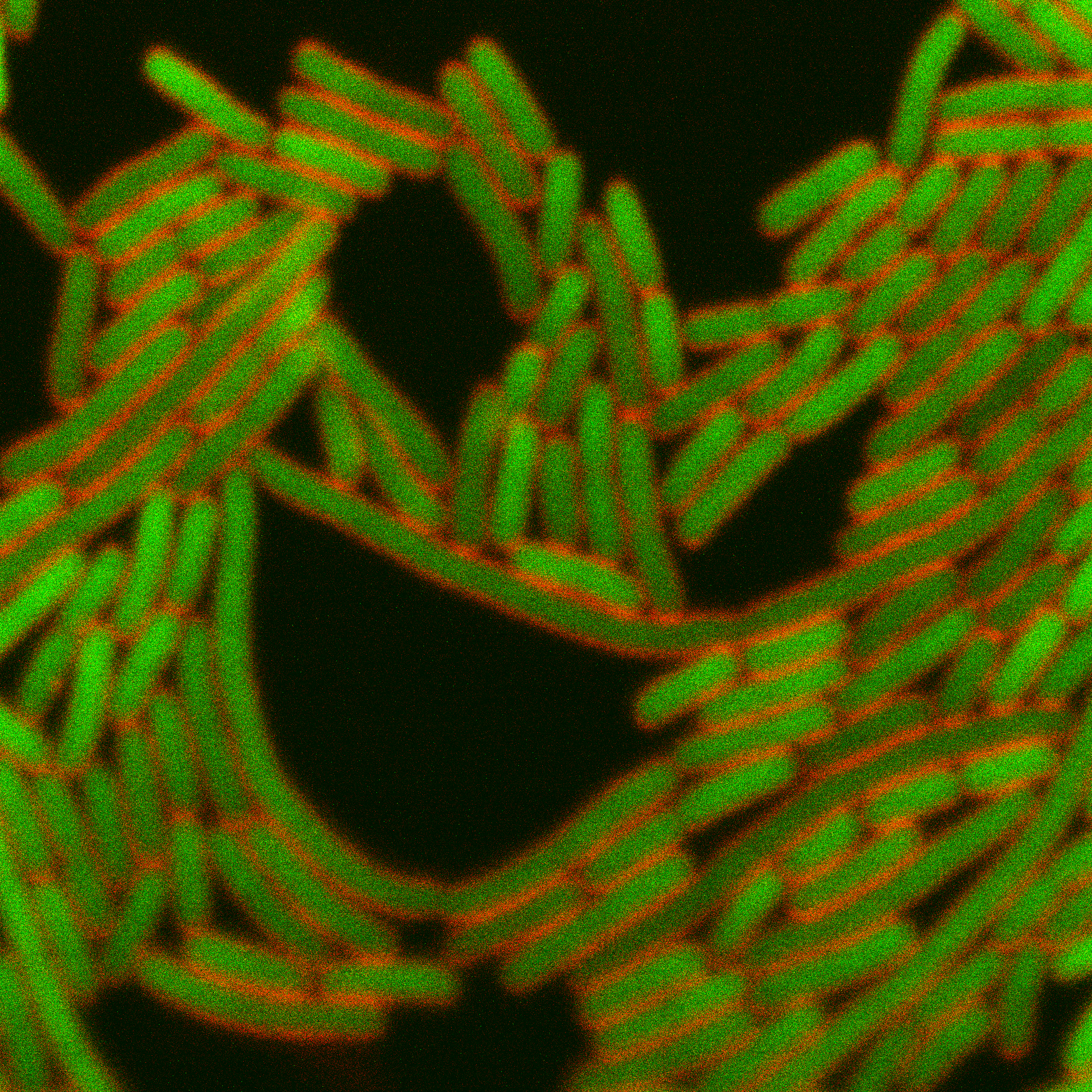 A cluster of green and red bacteria in a chain formation on a black background.