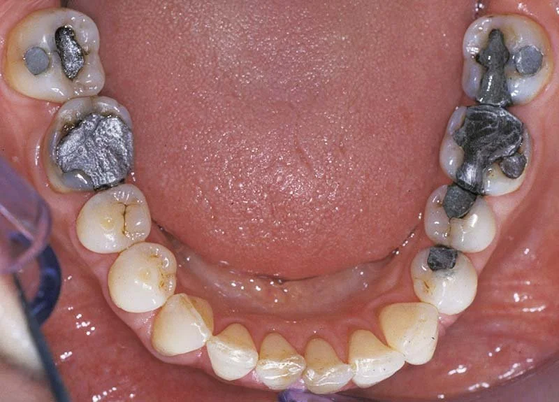 The Hidden Dangers of Heavy Metal Exposure Understanding Risks