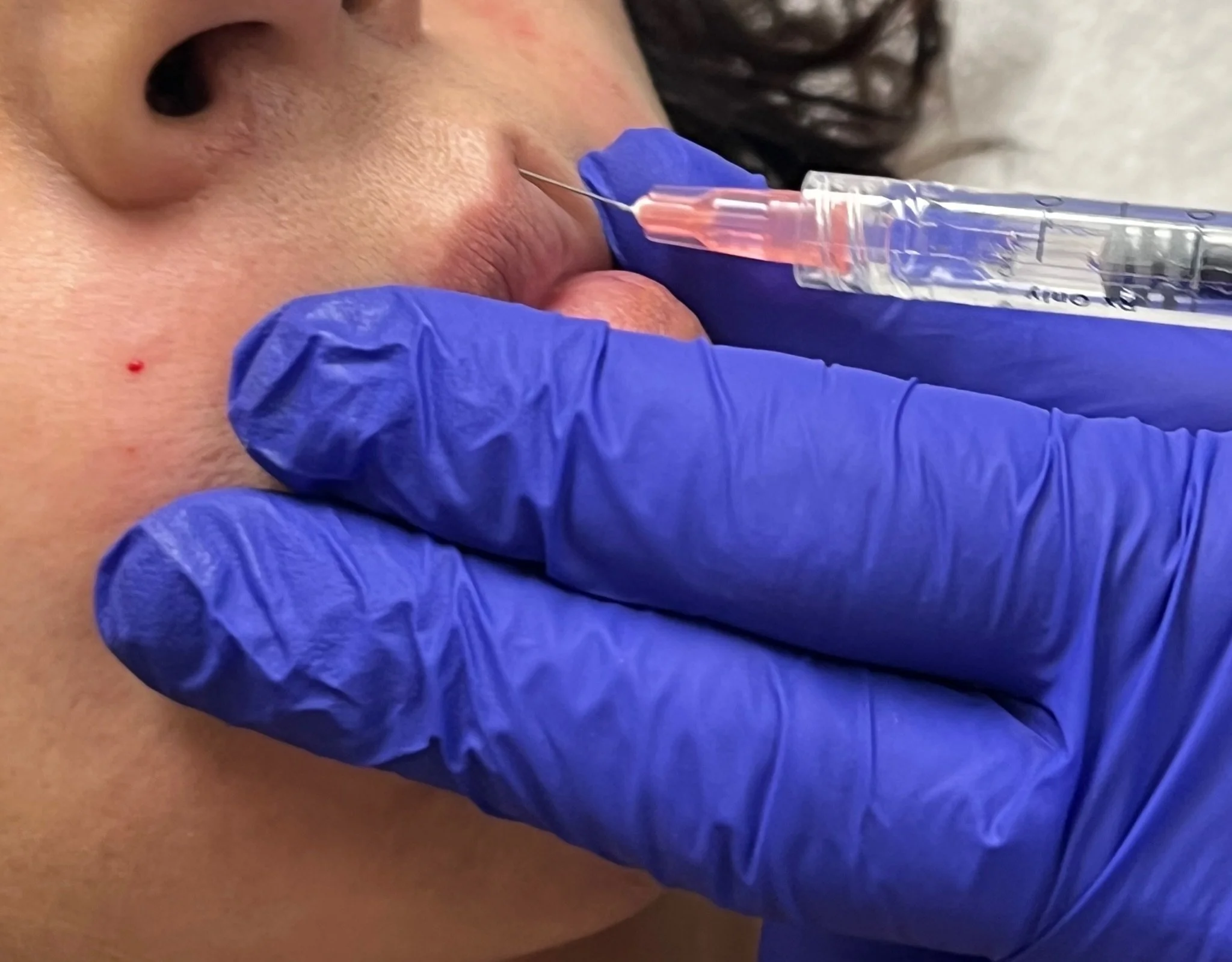 learn how to do cosmetic injections.JPG