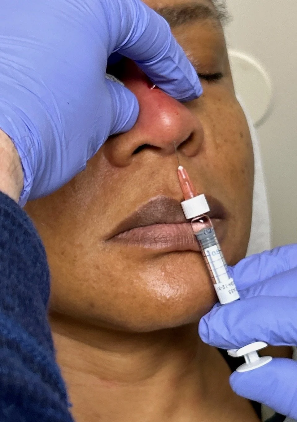 best cosmetic injection training in atlanta ga 9009.JPG