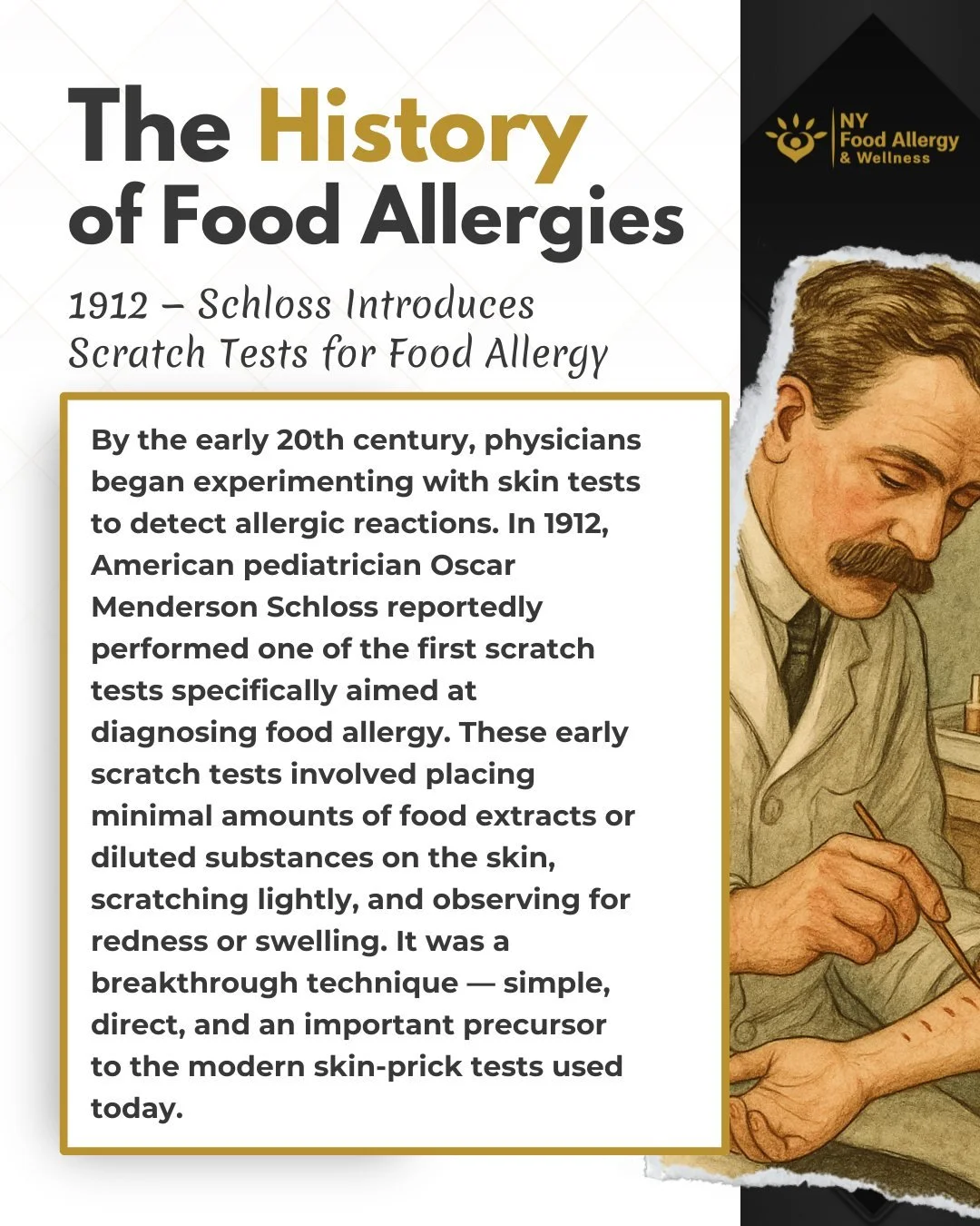 In 1912, Dr. Oscar Menderson Schloss introduced one of the first scratch tests for diagnosing food allergies. 🩺
By placing tiny amounts of food extract on scratched skin, he showed how visible redness or swelling could confirm allergic sensitivity.