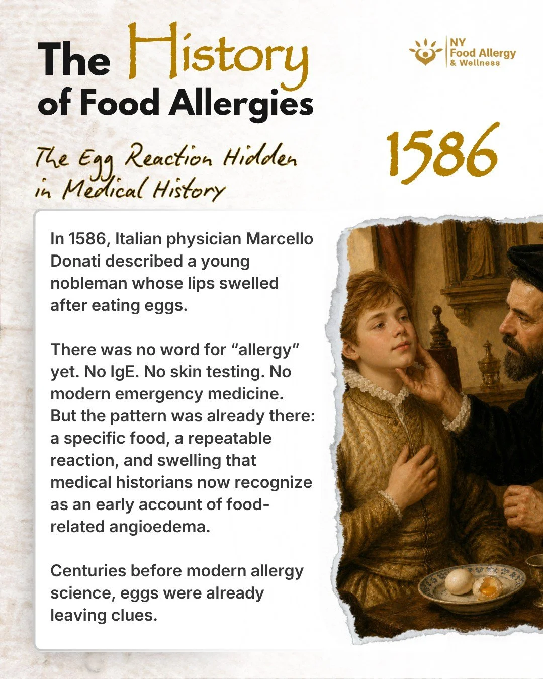 🥚 The History of Food Allergies: 1586

Centuries before the word &ldquo;allergy&rdquo; existed, physicians were already documenting food reactions that looked surprisingly familiar.

In 1586, Italian physician Marcello Donati described angioedema in