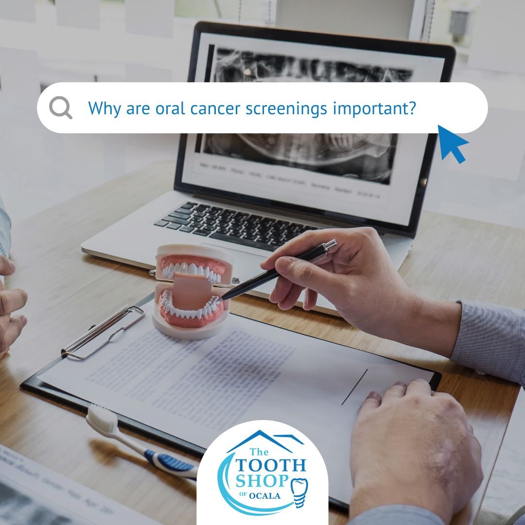 Why are oral cancer screenings important? Early detection saves lives. Regular screenings can detect abnormalities early, increasing treatment success rates. Schedule yours today. 

#OralCancerScreenings #TheToothShopofOcala