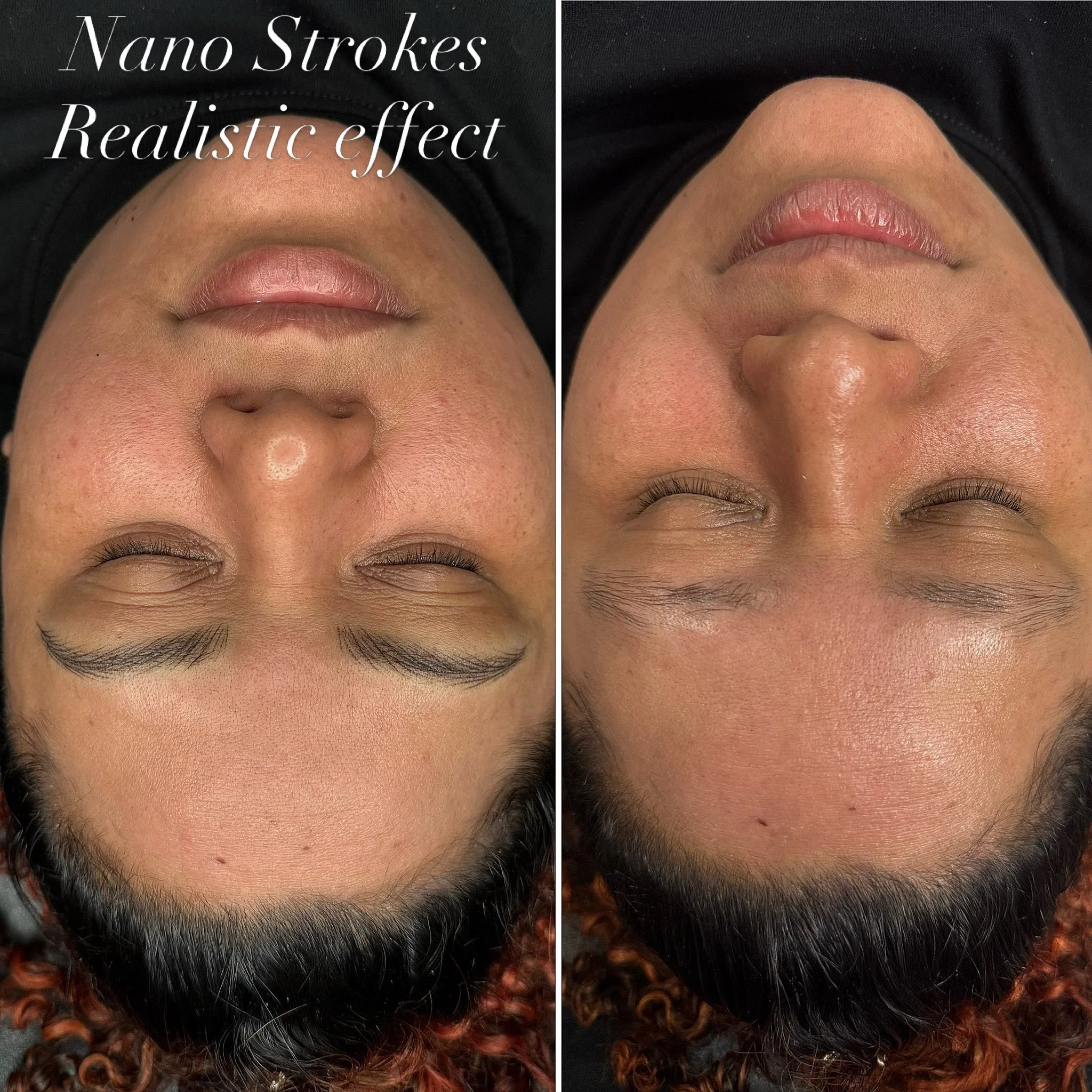 ✨ REALISTIC BROWS ARE ALWAYS THE GOAL. ✨

She came in with uneven, sparse brows and wanted something that looked natural, soft, and actually fit her face. 🤎

Using Nano Strokes, I was able to reshape her brows, improve the symmetry, and strategicall